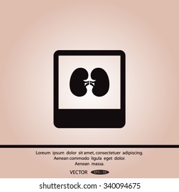 X-ray of kidney. icon.