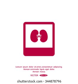 X-ray of kidney. icon.