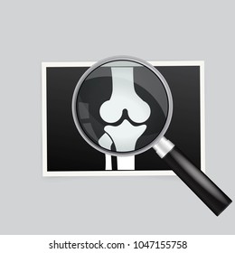 X-ray of the knee magnifying glass search