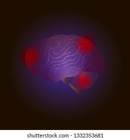 X-ray line Vector Medical illustration. Diseases of the brain with points of pain