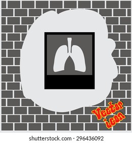 X-ray of Lungs