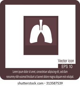 X-ray of Lungs