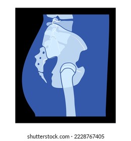 X-Ray pelvis Skeleton Hip Human body Bones adult people roentgen side view. 3D realistic flat blue color concept Vector illustration of medical anatomy isolated on black background