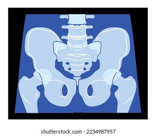 X-Ray pelvis Skeleton Hip Cuerpo humano Hueso adultos roentgen vista frontal. Concepto de color azul plano realista 3D Ilustración vectorial de la anatomía médica aislada en fondo negro