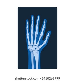 X-ray Pictures Of The Hand Reveal Internal Bone Structures, Joints, And Abnormalities, Aiding In Diagnosing Fractures