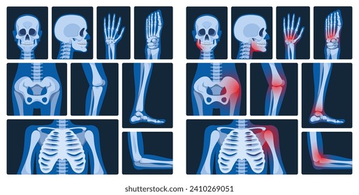 X-ray Pictures Are Medical Images Created By Exposing The Body To X-rays, Revealing Internal Structures For Diagnosing