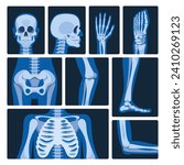 X-ray Pictures Vector Set. Medical Images Produced By Exposing The Body To Xrays, Revealing Internal Structures