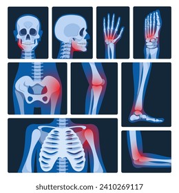 X-ray Pictures Vector Set. Medical Images Revealing Internal Structures Of The Body. They Help Diagnose Conditions