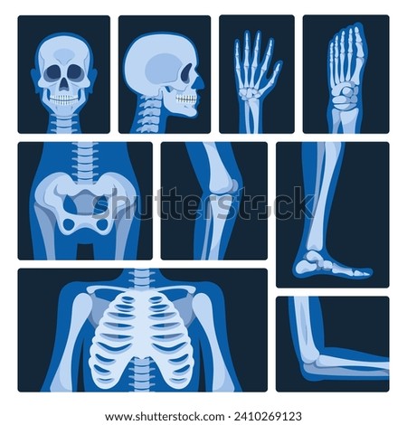 X-ray Pictures Vector Set. Medical Images Produced By Exposing The Body To Xrays, Revealing Internal Structures