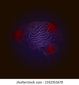 X-ray point Vector Medical illustration. Diseases of the brain with points of pain