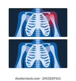 X-ray Radiographs Pictures Of Chest, Capture Images Of The Lungs And Surrounding Structures, Vector Illustration