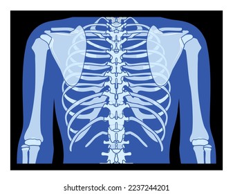 X-Ray rib cage and hands Skeleton Human body Bones adult people roentgen back view. 3D realistic flat blue color concept Vector illustration of medical anatomy isolated on black background