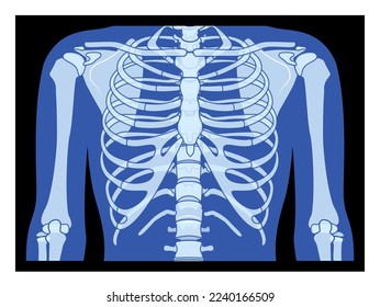 X-Ray rib cage and hands Skeleton Human body Bones adult people roentgen front view. 3D realistic flat blue color concept Vector illustration of medical anatomy isolated on black background