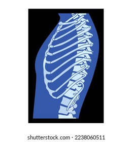 X-Ray Rib cage Skeleton Human body - chest, vertebra, Bones adult people roentgen side view. 3D realistic flat blue color concept Vector illustration of medical anatomy isolated on black background