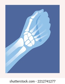 Xray scan. Anatomical poster with bones and joints of hand, palm and fingers. Medical infographic of human skeleton. Design element for banner. Cartoon flat vector illustration on white background