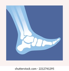 Xray scan concept. Anatomical poster with bones and joints of foot. Medical diagnosis and treatment of injuries. Design element for website. Cartoon flat vector illustration on white background