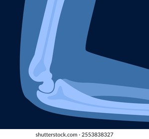 Xray scan of elbow joint. Anatomical structure, care and diagnosis for pain in arm. Rheumatism and surgery, clinics and hospital treatment and cure. Vector illustration