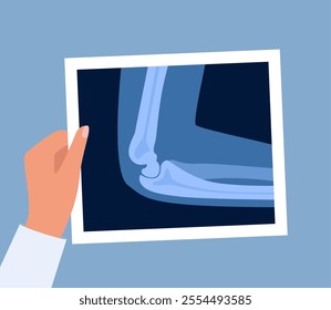 Xray scan of elbow joint. Anatomical structure, care and diagnosis for pain in arm. Roentgen shot in doctors hand. Vector illustration