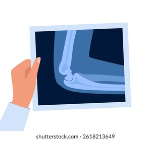 Xray scan of elbow joint. Anatomical structure, care and diagnosis for pain in arm. Roentgen shot in doctors hand. Vector illustration