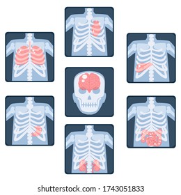 X-ray screen showing internal organs and skeleton. Element of educational infographics for peoples. Isolated vector clip art illustration.