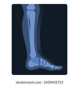 Xray shot of human leg. Medical skeleton test, body radiography cartoon vector illustration