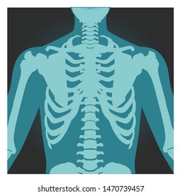 X-ray shot of shoulder, human body bones, radiography, rib cage, chest and arm, vector illustration