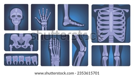 X-ray shots. Human skeleton and body parts, medical diagnosis and healthcare concept, anatomy and science vector set. Radiology for medicine, chest, knee, teeth and foot trauma or fracture