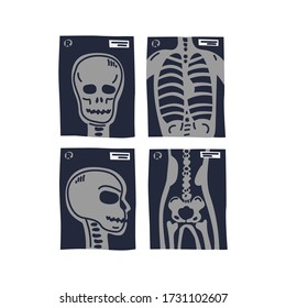 X-ray shots. Stylized x-ray pictures of human chest, head in front and side view and coxal. Medical care and health. Flat style vector illustration on white background
