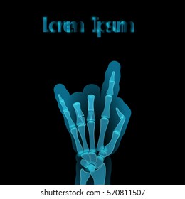 X-ray Vector illustration Biker hand gesture on an x-ray with description Realistic style