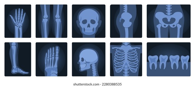 Xrays films of human body set, radiography and anatomy vector illustration. Cartoon isolated medical roentgen scans with silhouettes of bones of skeleton, joint and articulation of legs and hands