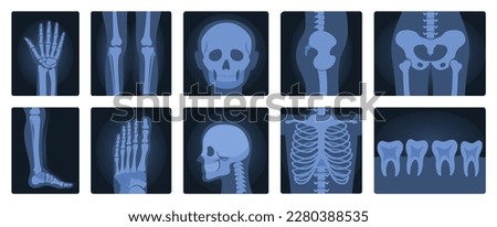 Xrays films of human body set, radiography and anatomy vector illustration. Cartoon isolated medical roentgen scans with silhouettes of bones of skeleton, joint and articulation of legs and hands