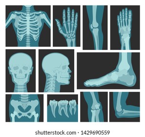 X-rays of human body, medical equipment. Photographic or digital image for doctors to examine bones or organs inside. Vector x-rays of bones illustration.