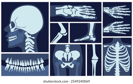 Conjunto de Imágenes de rayos X. Radiografías con huesos, cráneo, pelvis, brazos y piernas. Artritis y osteoartritis. Diagnóstico y tratamiento. Salud y medicina. Colección plana del Vector aislada en el fondo blanco