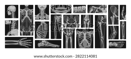 X-rays set. Xray shots of different bones of human body. Diagnostics of fractures with roentgen rays. Radiology and radiography. Examination of skeleton. Black and white flat vector illustrations