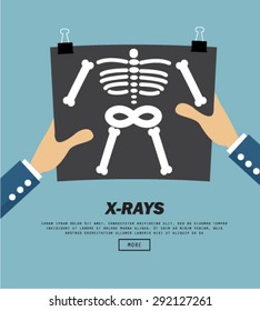 X-Rays, vector illustration