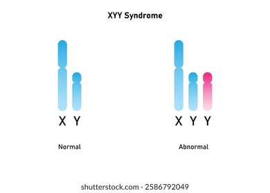 XYY Syndrome Science Design. Vector Illustration.