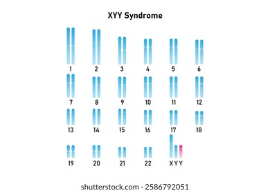 XYY Syndrome Science Design. Vector Illustration.