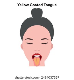 Yellow coated tongue disease in human