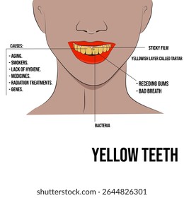 Dentes amarelos, falta de higiene oral e acúmulo de placa bacteriana.
