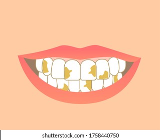 Yellow  teeth and whitening illustration