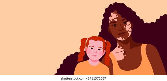 Young  African American mother with vitiligo and adopted daughter. Copy space template, motherhood or adoption concept. Banner on the theme of family. Flat vector illustration of people and children.