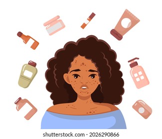 A young African-American woman with problematic skin. Pimples and acne. A woman surrounded by special cosmetics for skin care. Protecting the skin of the face and preserving beauty. Vector.