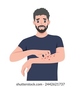 Young bearded man scratching hand and arm. Man suffering from strong allergy skin itchy symptom. Flat vector illustration isolated on white background