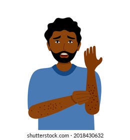 Young Black Man Scratching Arm. African Guy Suffering From Strong Allergy Skin Itchy Symptom In Flat Design. Red Rash Skin Irritation.