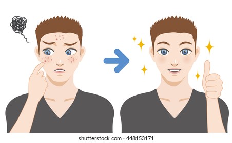 el tratamiento del acné infantil antes y después, espuma de limpieza facial, cuidado de la piel de los hombres, ilustración de dibujos animados