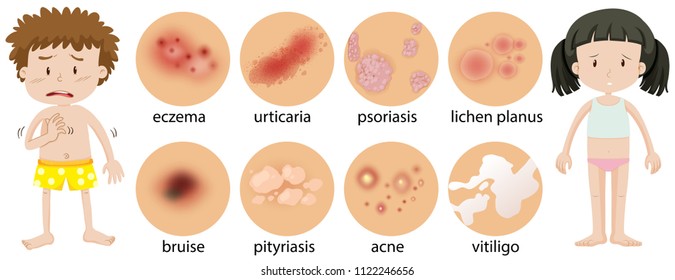 Young children with different skin conditions illustration