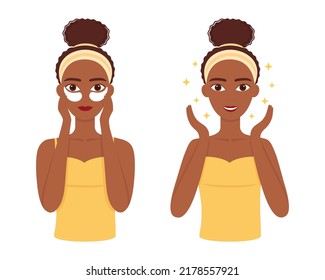 Young dark skinned woman care her skin around eyes. Beautiful girl with patches under eyes. Vector illustration