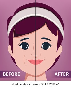 The young female face. Lifting and anti-aging. the portrait of beautiful woman surgery clinic.