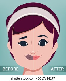 The young female face. Plastic and botox. the portrait of beautiful woman surgery clinic.