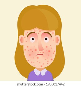 A young girl with acne on her face, a facial rash and skin irritation. Allergic reaction on face, disease, puberty. Vector illustration, flat design, cartoon style, isolated background, portrait.